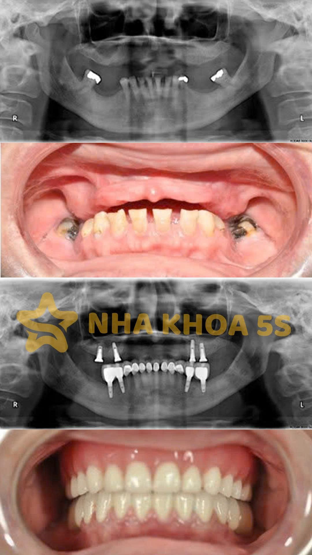 3Bb2E62Ca775262B7F64 15