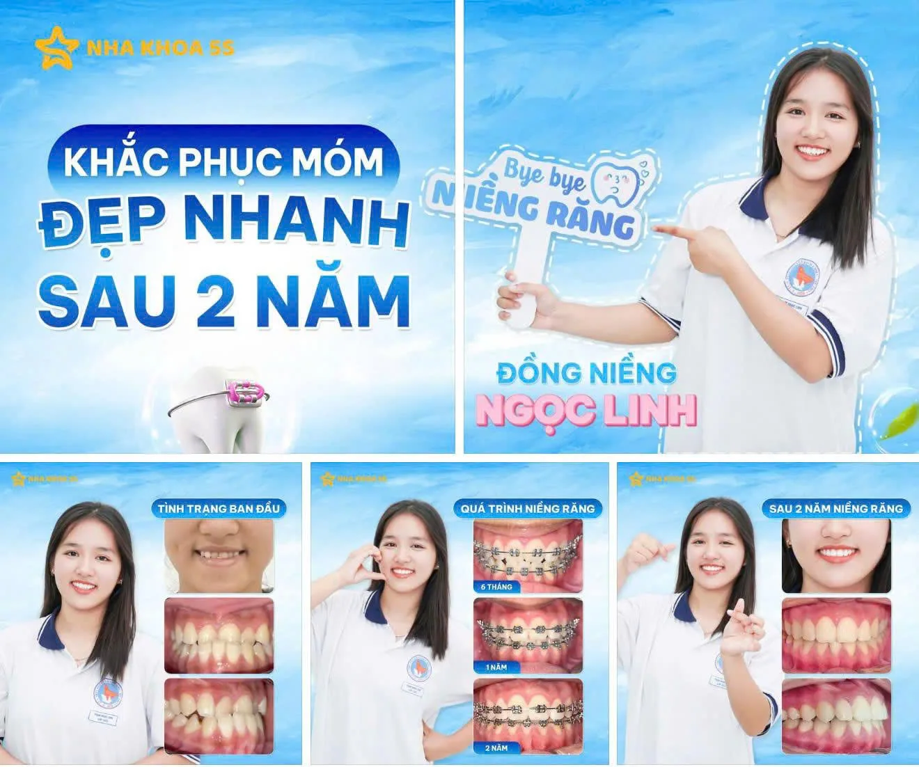 Khách Hàng Niềng Răng 13