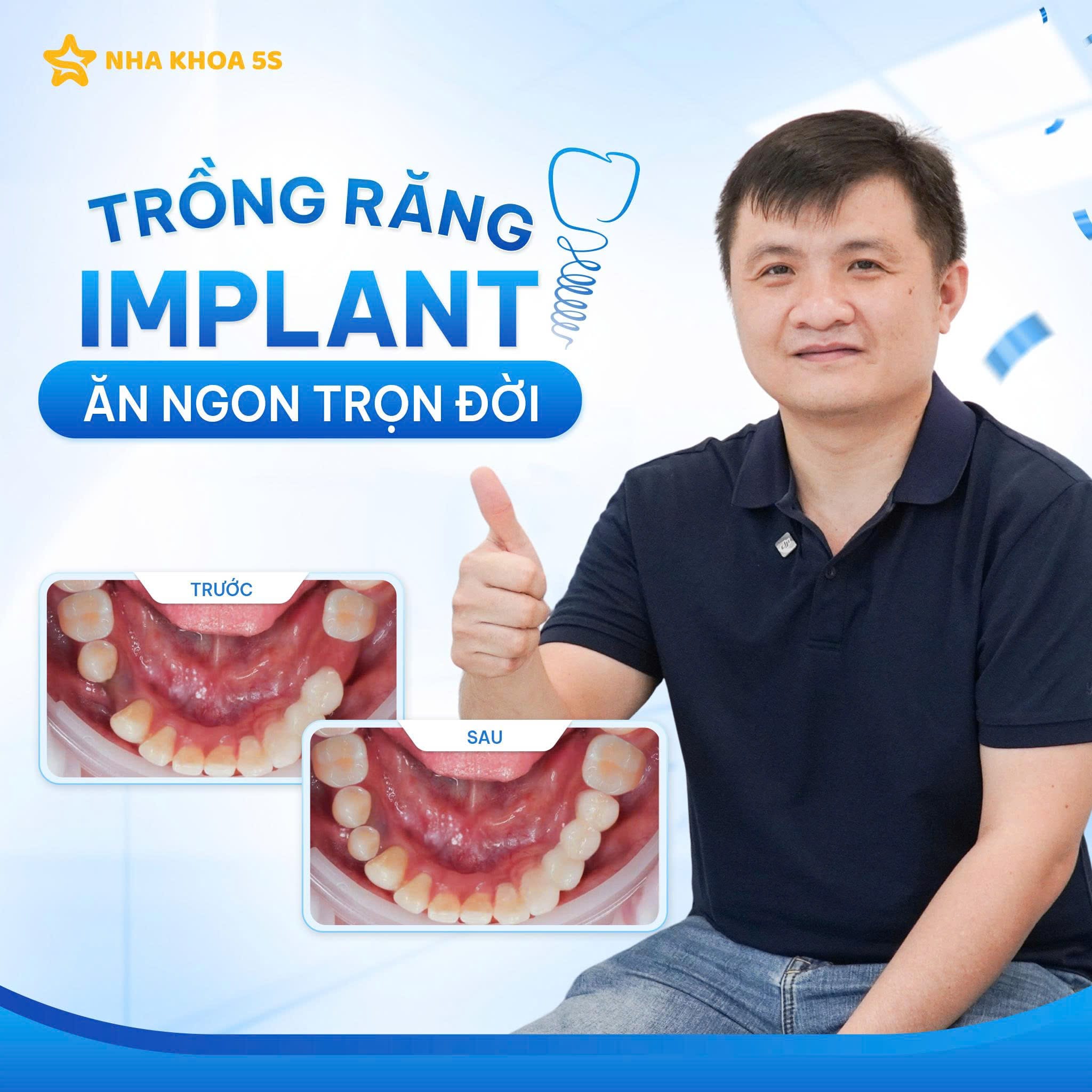Khách Hàng Implant 2
