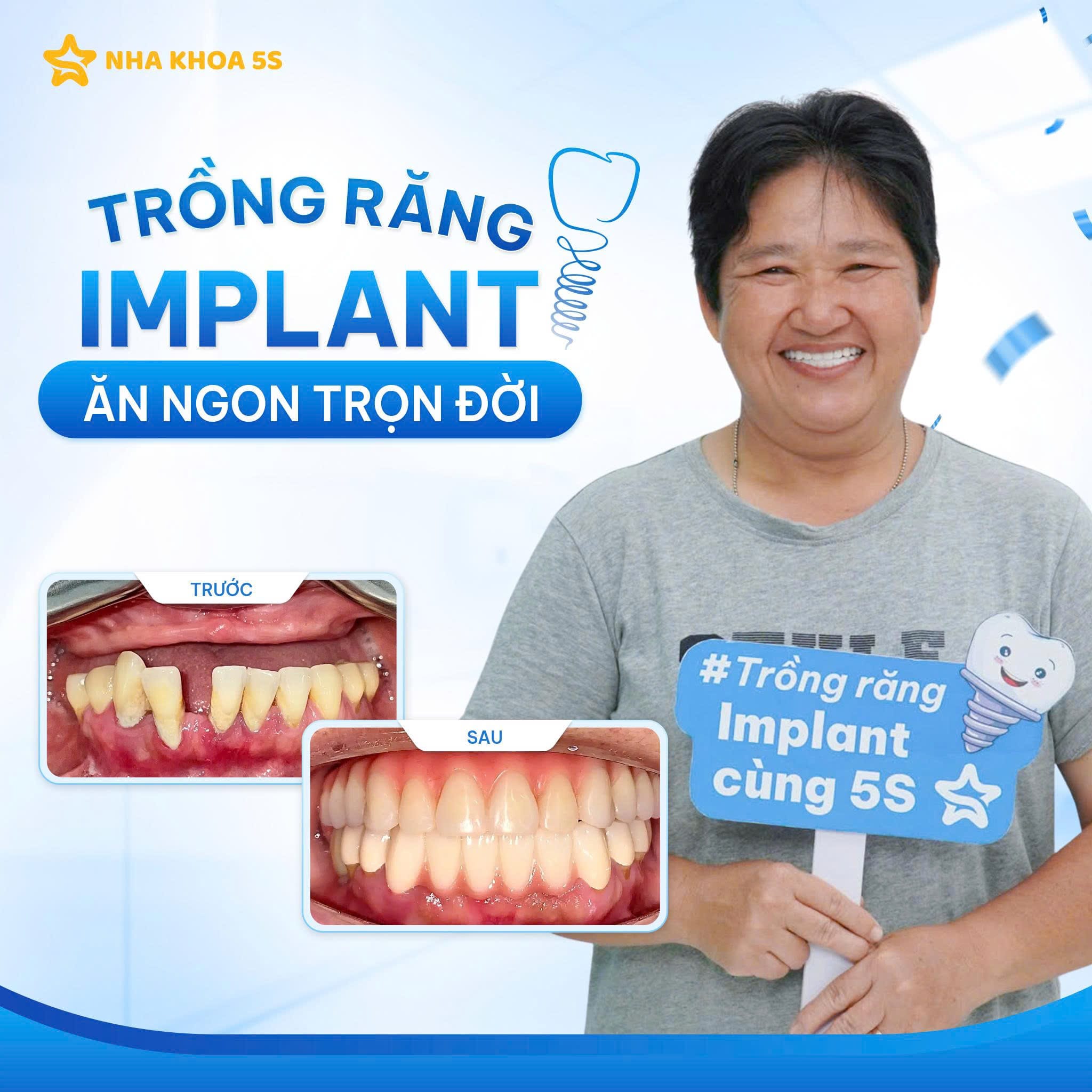 Khách Hàng Implant 4