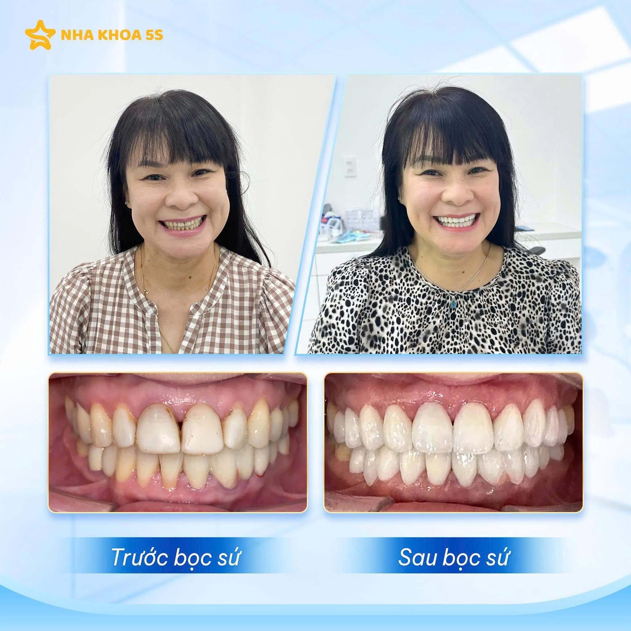 Hình Ảnh Khách Hàng Thực Tế Tại Nha Khoa 5S