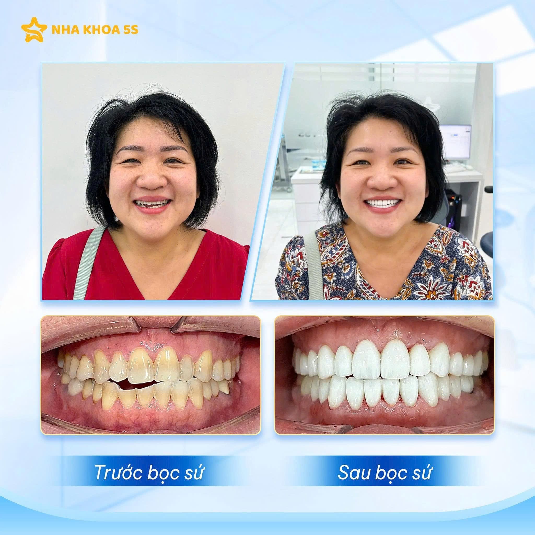Hình Ảnh Khách Hàng Thực Tế Tại Nha Khoa 5S
