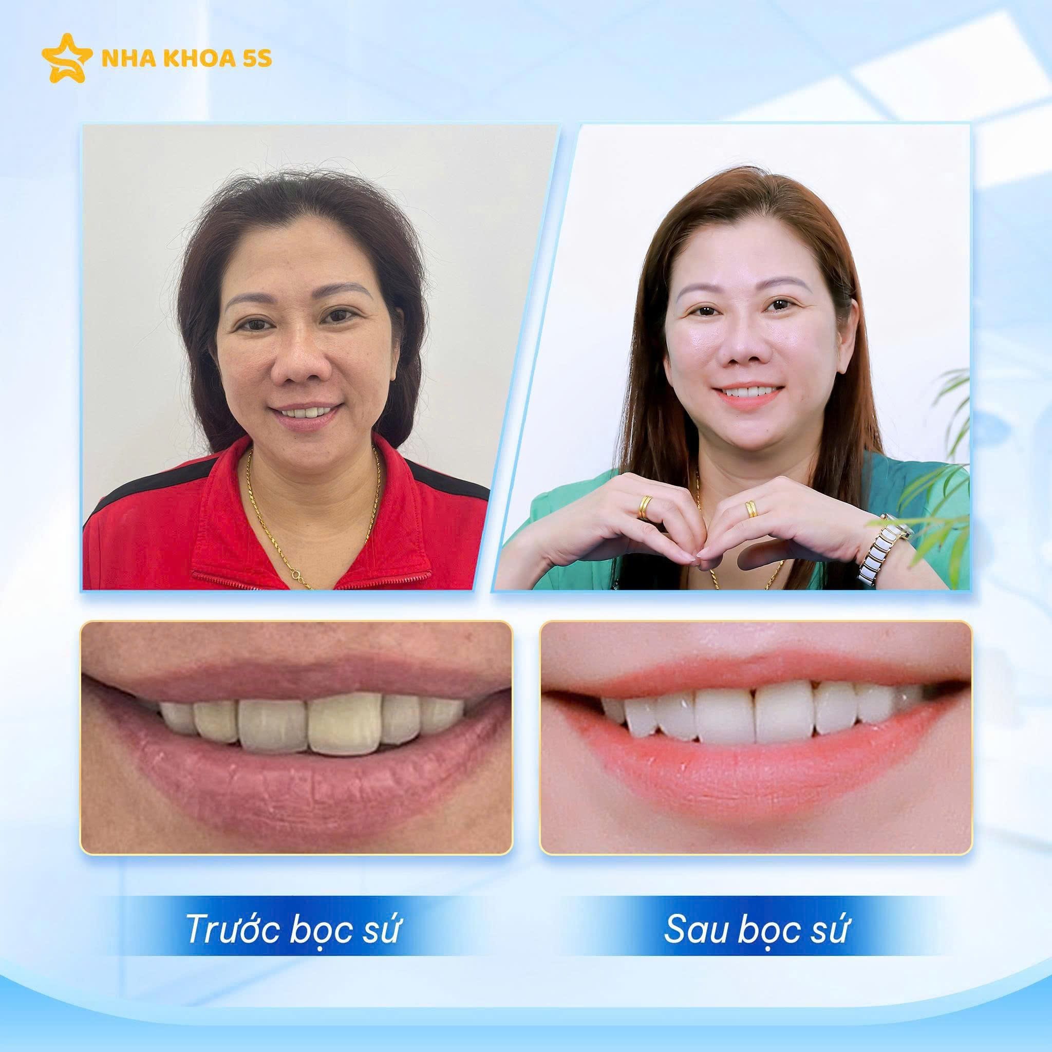 Hình Ảnh Khách Hàng Thực Tế Tại Nha Khoa 5S