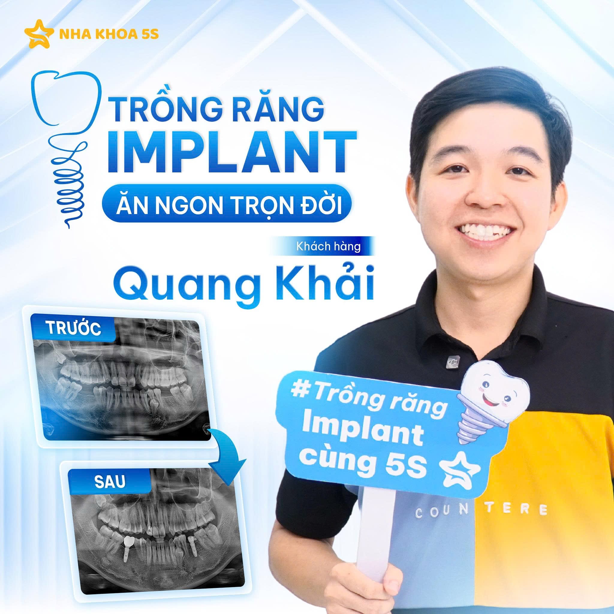Khách Hàng Implant 6