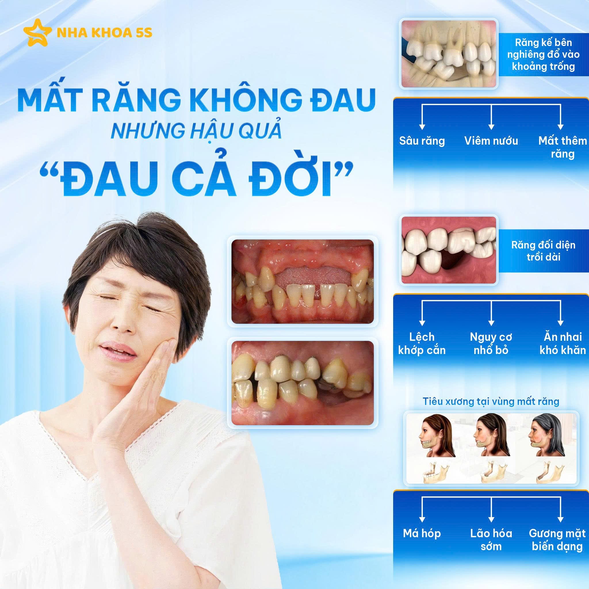 Khách Hàng Implant 7