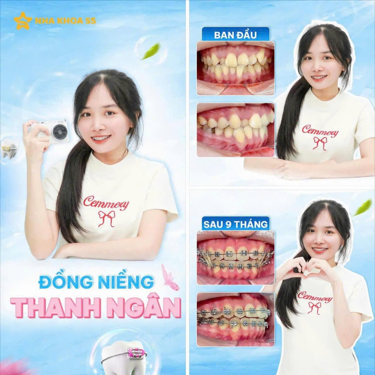 Khách Hàng Niềng Răng 15