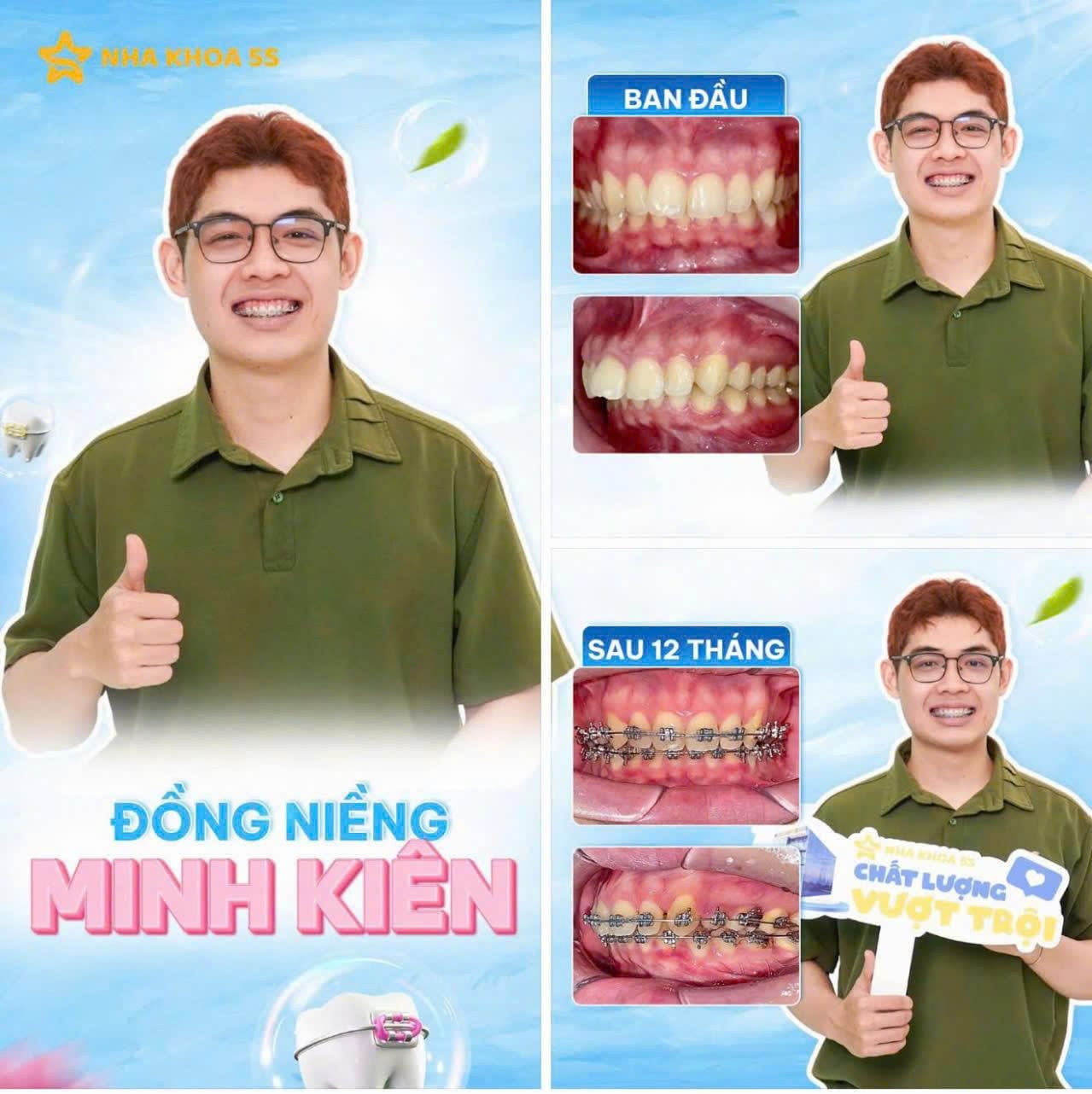 Khách Hàng Niềng Răng 18