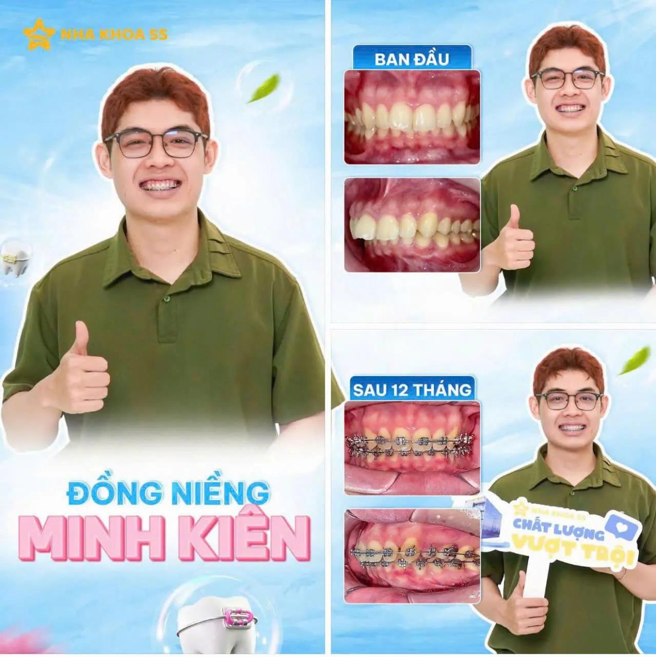 Khách Hàng Niềng Răng 18