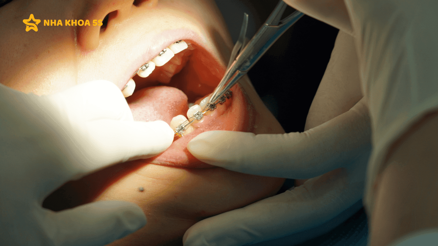 Địa Chỉ Niềng Răng Uy Tín: Tiêu Chí Lựa Chọn &Amp;Amp; Gợi Ý Địa Điểm Đáng Tin Cậy 2026