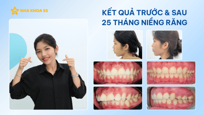 Nha Khoa 5S Vào Top 10 Thương Hiệu Nha Khoa Niềng Răng &Amp;Amp; Implant Việt Nam 2026