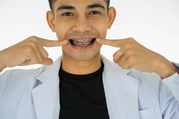 Niềng Răng Giá Bao Nhiêu? Bảng Giá Chi Tiết &Amp;Amp; Cách Tiết Kiệm Chi Phí (2026)