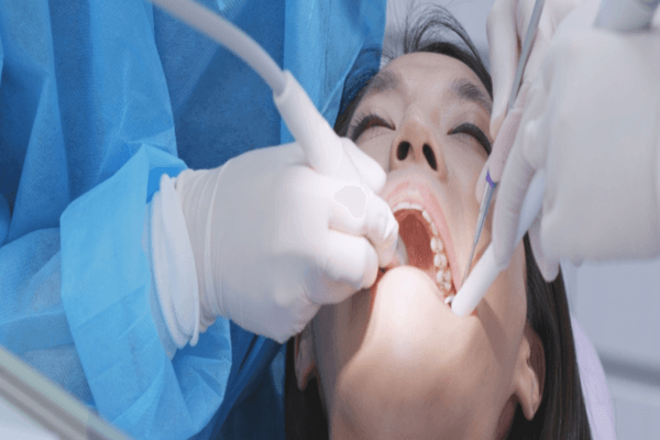 Niềng Răng Giá Bao Nhiêu? Bảng Giá Chi Tiết &Amp;Amp; Cách Tiết Kiệm Chi Phí (2026)