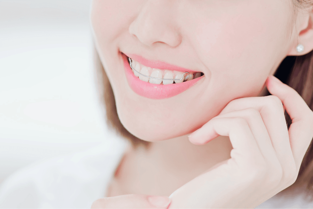 Niềng Răng Có Đau Không? Sự Thật Bạn Cần Biết Trước Khi Quyết Định (2026)