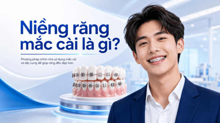 Niềng Răng Mắc Cài Là Gì? Tất Tần Tật Thông Tin Cần Biết Trước Khi Chỉnh Nha Niềng Răng Mắc Cài Là Gì? Tất Tần Tật Thông Tin Cần Biết Trước Khi Chỉnh Nha