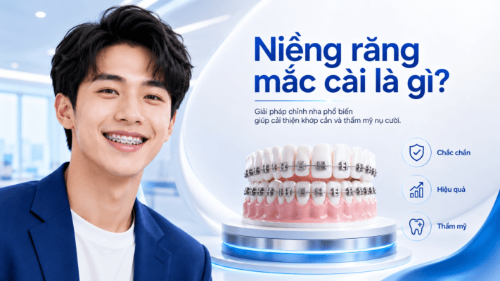 Niềng Răng Mắc Cài Là Gì? Tất Tần Tật Thông Tin Cần Biết Trước Khi Chỉnh Nha Niềng Răng Mắc Cài Là Gì? Tất Tần Tật Thông Tin Cần Biết Trước Khi Chỉnh Nha