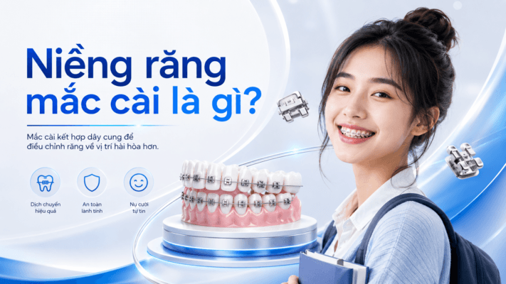 Niềng Răng Mắc Cài Là Gì? Tất Tần Tật Thông Tin Cần Biết Trước Khi Chỉnh Nha Niềng Răng Mắc Cài Là Gì? Tất Tần Tật Thông Tin Cần Biết Trước Khi Chỉnh Nha