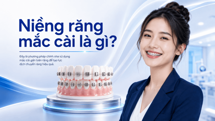 Niềng Răng Mắc Cài Là Gì? Tất Tần Tật Thông Tin Cần Biết Trước Khi Chỉnh Nha Niềng Răng Mắc Cài Là Gì? Tất Tần Tật Thông Tin Cần Biết Trước Khi Chỉnh Nha