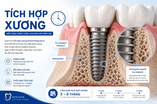 Trồng Răng Implant Hoạt Động Như Thế Nào? Trồng Răng Implant Hoạt Động Như Thế Nào?