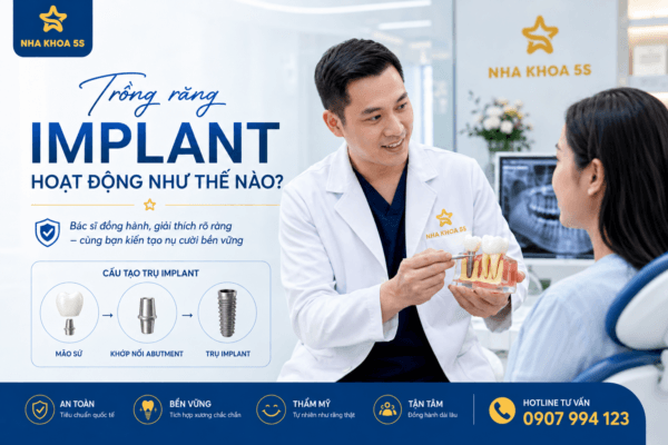 Trồng Răng Implant Hoạt Động Như Thế Nào? Trồng Răng Implant Hoạt Động Như Thế Nào?