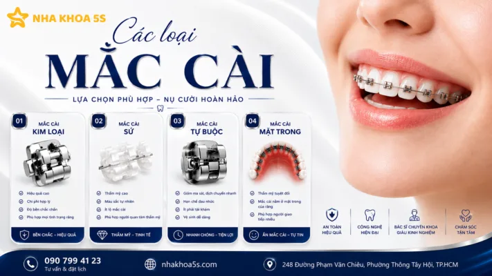 Các Loại Mắc Cài Phổ Biến Hiện Nay – Nên Chọn Loại Nào Tốt Nhất?
