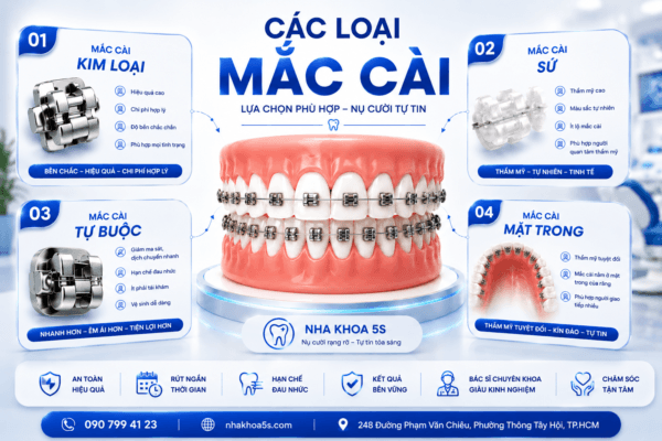 Các Loại Mắc Cài Phổ Biến Hiện Nay – Nên Chọn Loại Nào Tốt Nhất? Các Loại Mắc Cài Phổ Biến Hiện Nay – Nên Chọn Loại Nào Tốt Nhất?