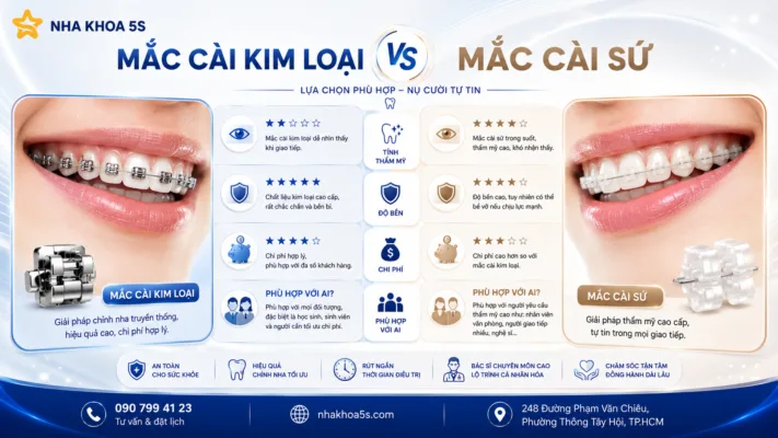 Mắc Cài Kim Loại Vs Sứ: Nên Chọn Loại Nào Khi Niềng Răng
