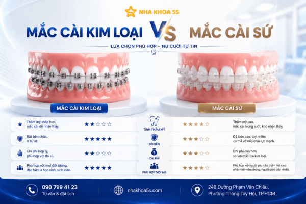 Mắc Cài Kim Loại Vs Sứ: Nên Chọn Loại Nào Khi Niềng Răng