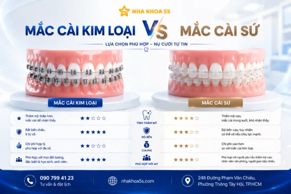Mắc Cài Kim Loại Vs Sứ: Nên Chọn Loại Nào Khi Niềng Răng