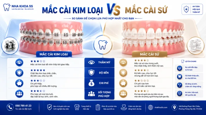 Mắc Cài Kim Loại Vs Sứ: Nên Chọn Loại Nào Khi Niềng Răng