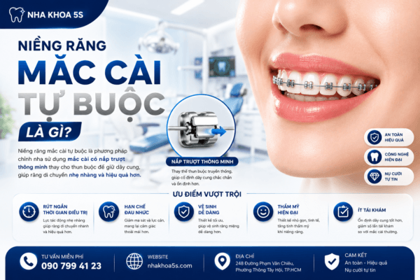 Niềng Răng Mắc Cài Tự Buộc Là Gì? Ưu Nhược Điểm Và Những Điều Cần Biết Trước Khi Chỉnh Nha Niềng Răng Mắc Cài Tự Buộc Là Gì? Ưu Nhược Điểm Và Những Điều Cần Biết Trước Khi Chỉnh Nha