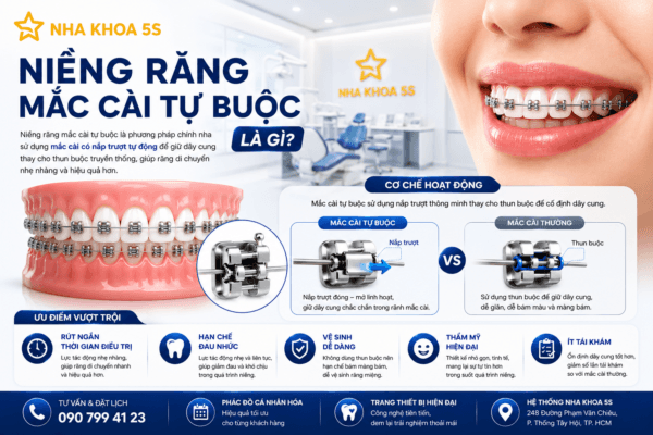 Niềng Răng Mắc Cài Tự Buộc Là Gì? Ưu Nhược Điểm Và Những Điều Cần Biết Trước Khi Chỉnh Nha Niềng Răng Mắc Cài Tự Buộc Là Gì? Ưu Nhược Điểm Và Những Điều Cần Biết Trước Khi Chỉnh Nha