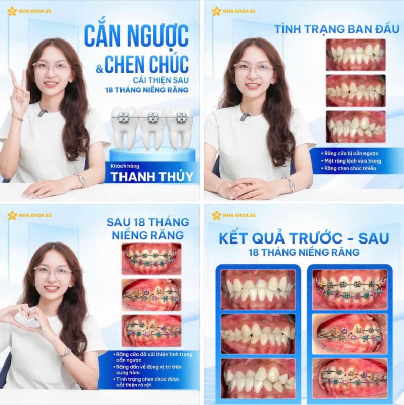 Nha Khoa 5S Gò Vấp Hồ Chí Minh Z7770605593801 Cf1D54344D56E7B0Fb826D74Ec47A0C0 13