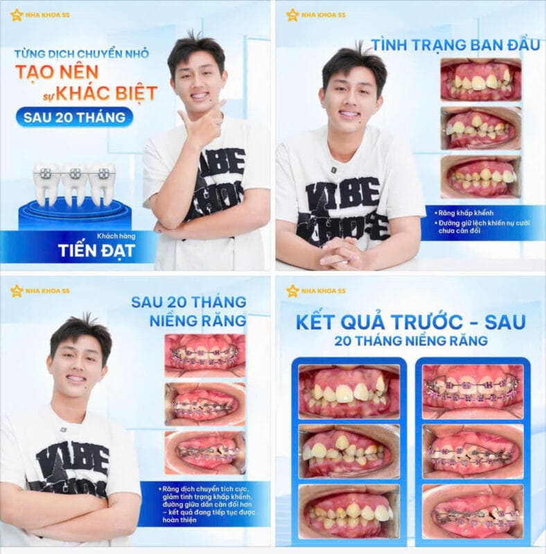 Nha Khoa 5S Gò Vấp Hồ Chí Minh Z7770606190829 5E621Baabfe806Fd8B094C2Aa40F019C 13