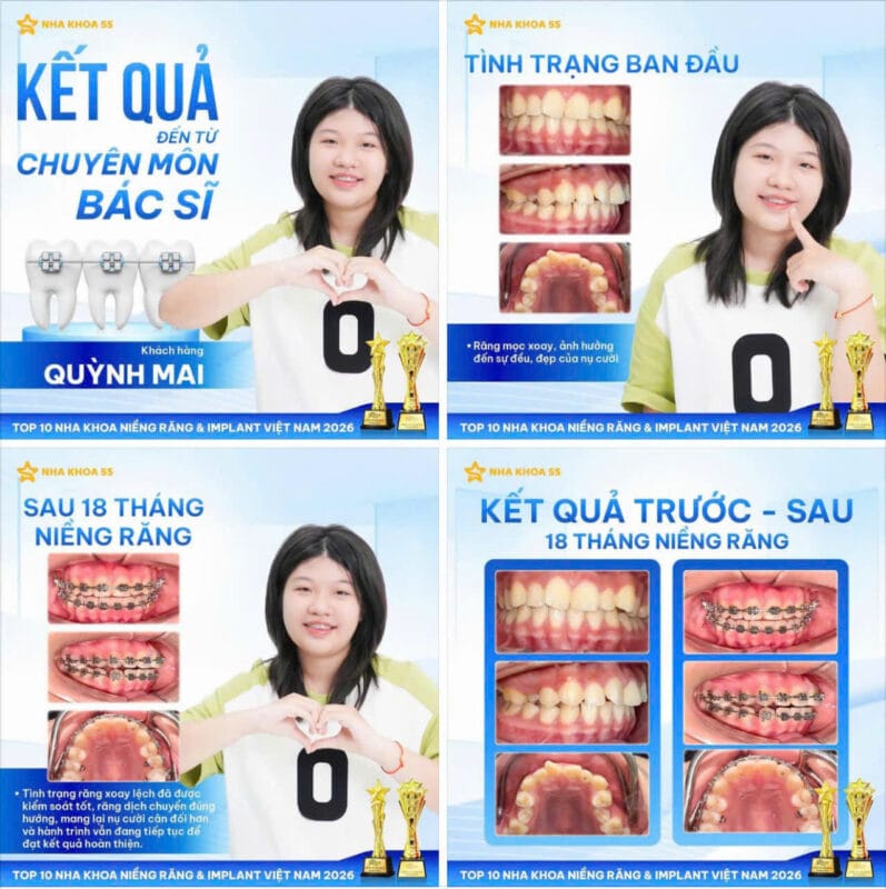 Nha Khoa 5S Gò Vấp Hồ Chí Minh Z7770606518606 5605B46711885Fb0Aa07A8D62Bc55E83 13