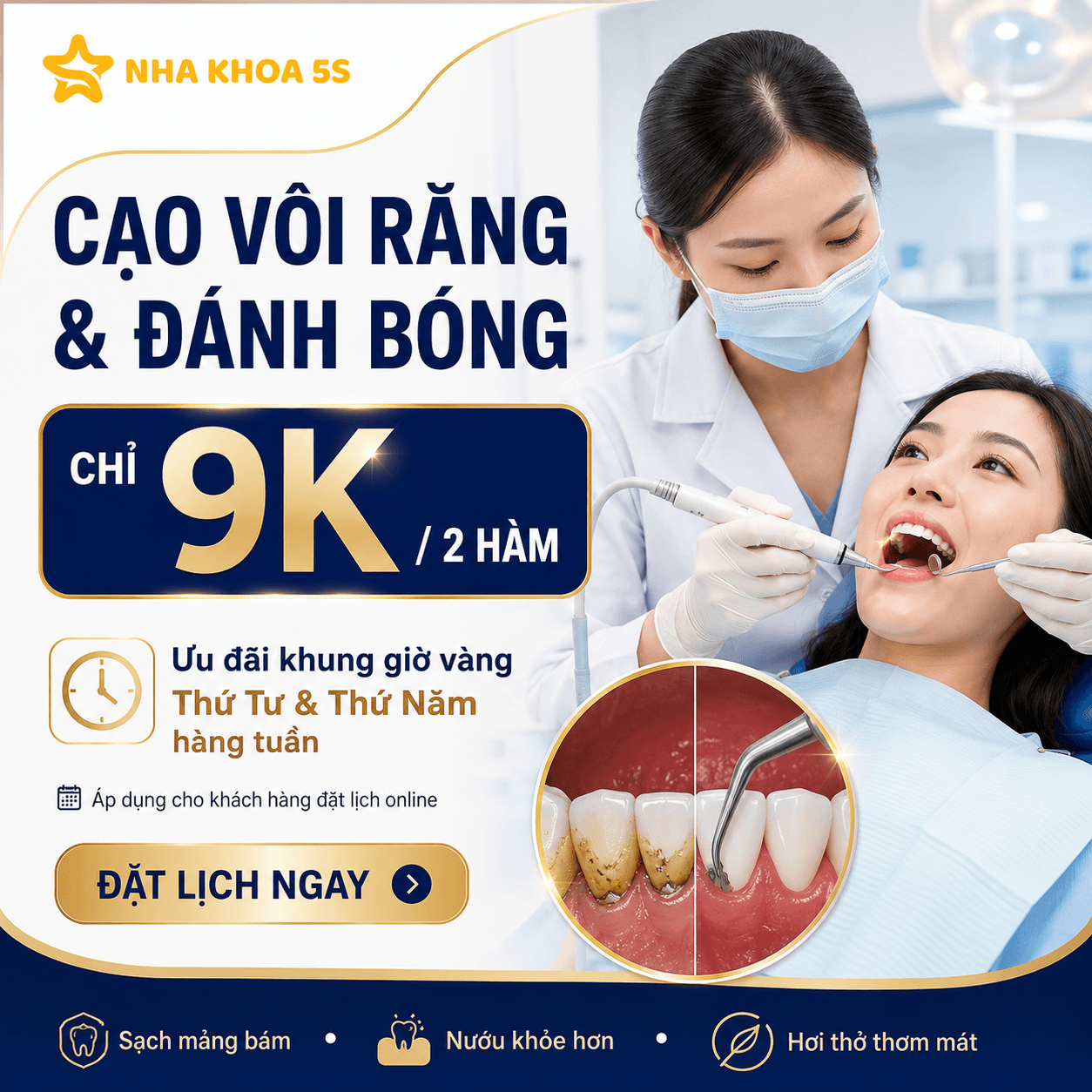 Quy Trình Cạo Vôi Răng Tại Nha Khoa 5S