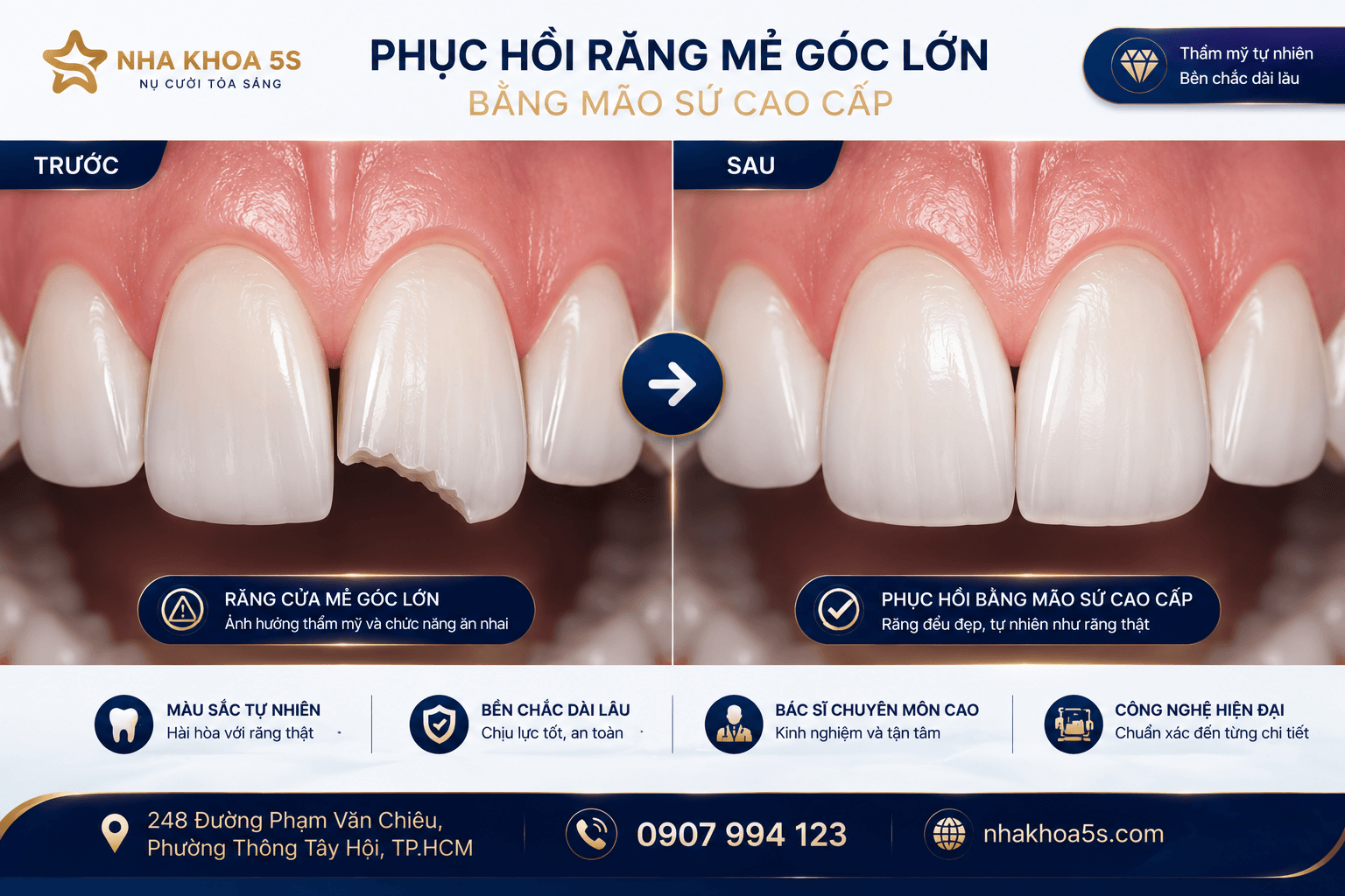Khi Nào Nên Bọc Sứ? 9 Trường Hợp Nên Bọc Răng Sứ Để Sở Hữu Nụ Cười Đẹp Tự Nhiên