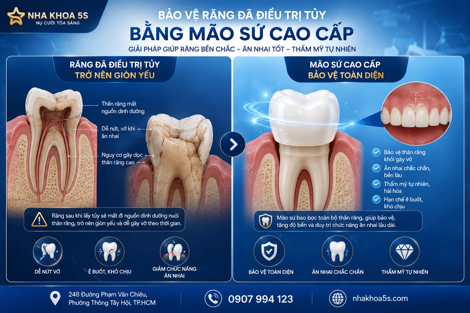 Khi Nào Nên Bọc Sứ? 9 Trường Hợp Nên Bọc Răng Sứ Để Sở Hữu Nụ Cười Đẹp Tự Nhiên