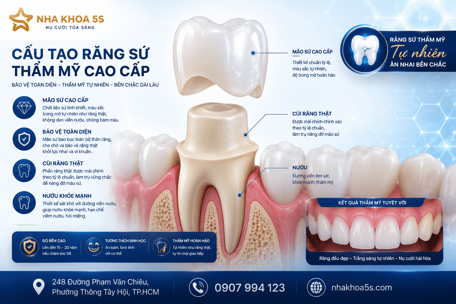 Khi Nào Nên Bọc Sứ? 9 Trường Hợp Nên Bọc Răng Sứ Để Sở Hữu Nụ Cười Đẹp Tự Nhiên