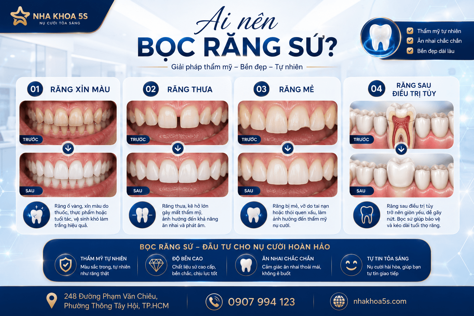 Khi Nào Nên Bọc Sứ? 9 Trường Hợp Nên Bọc Răng Sứ Để Sở Hữu Nụ Cười Đẹp Tự Nhiên