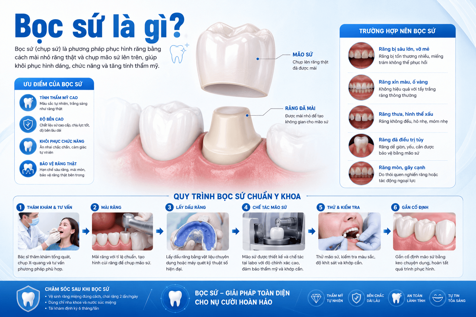 Bọc Sứ Là Gì? Tất Tần Tật Về Bọc Răng Sứ Thẩm Mỹ Bạn Nên Biết Bọc Sứ Là Gì? Tất Tần Tật Về Bọc Răng Sứ Thẩm Mỹ Bạn Nên Biết