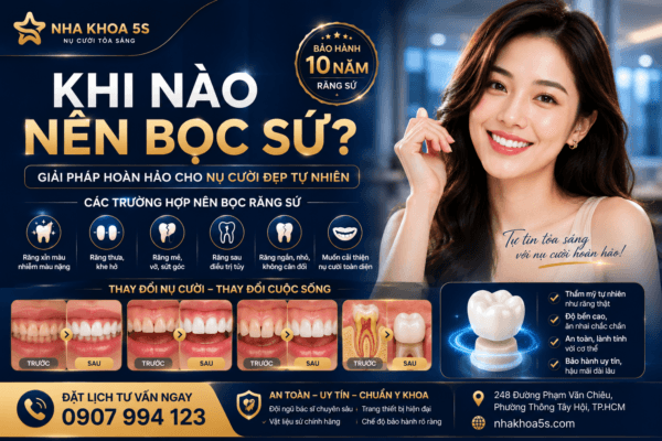 Khi Nào Nên Bọc Sứ