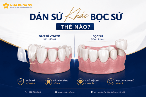 Dán Sứ Khác Bọc Sứ Thế Nào