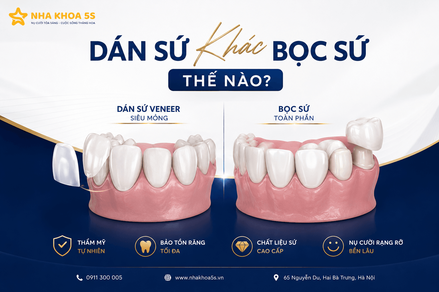 Dán Sứ Khác Bọc Sứ Thế Nào? So Sánh Chi Tiết Để Chọn Đúng Giải Pháp Cho Nụ Cười
