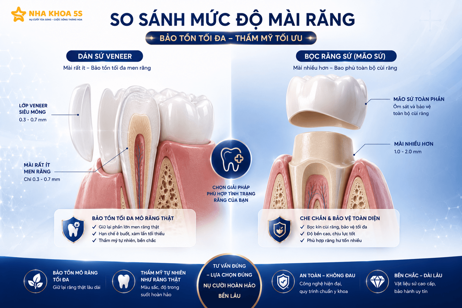 Dán Sứ Khác Bọc Sứ Thế Nào? So Sánh Chi Tiết Để Chọn Đúng Giải Pháp Cho Nụ Cười