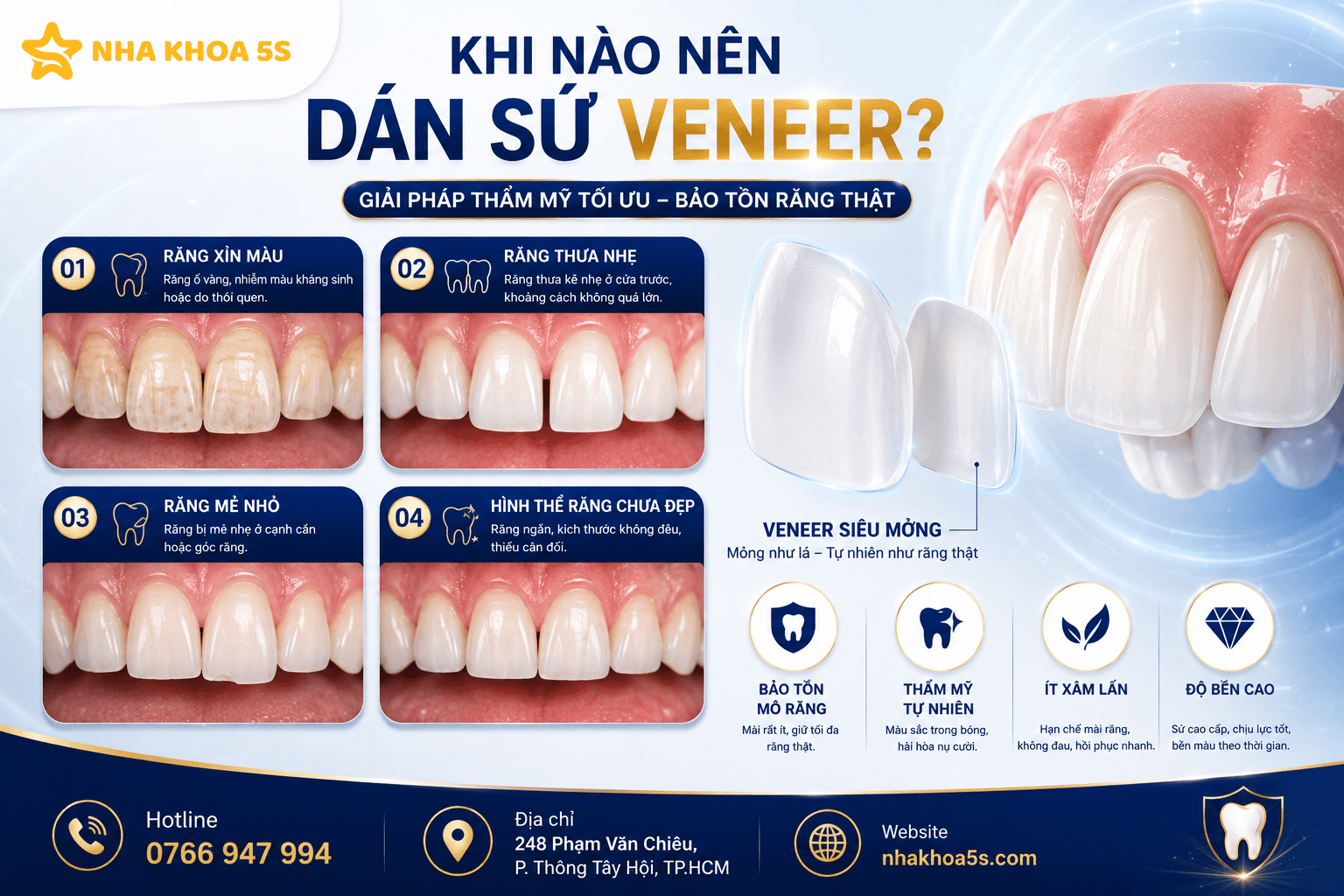 Dán Sứ Khác Bọc Sứ Thế Nào? So Sánh Chi Tiết Để Chọn Đúng Giải Pháp Cho Nụ Cười
