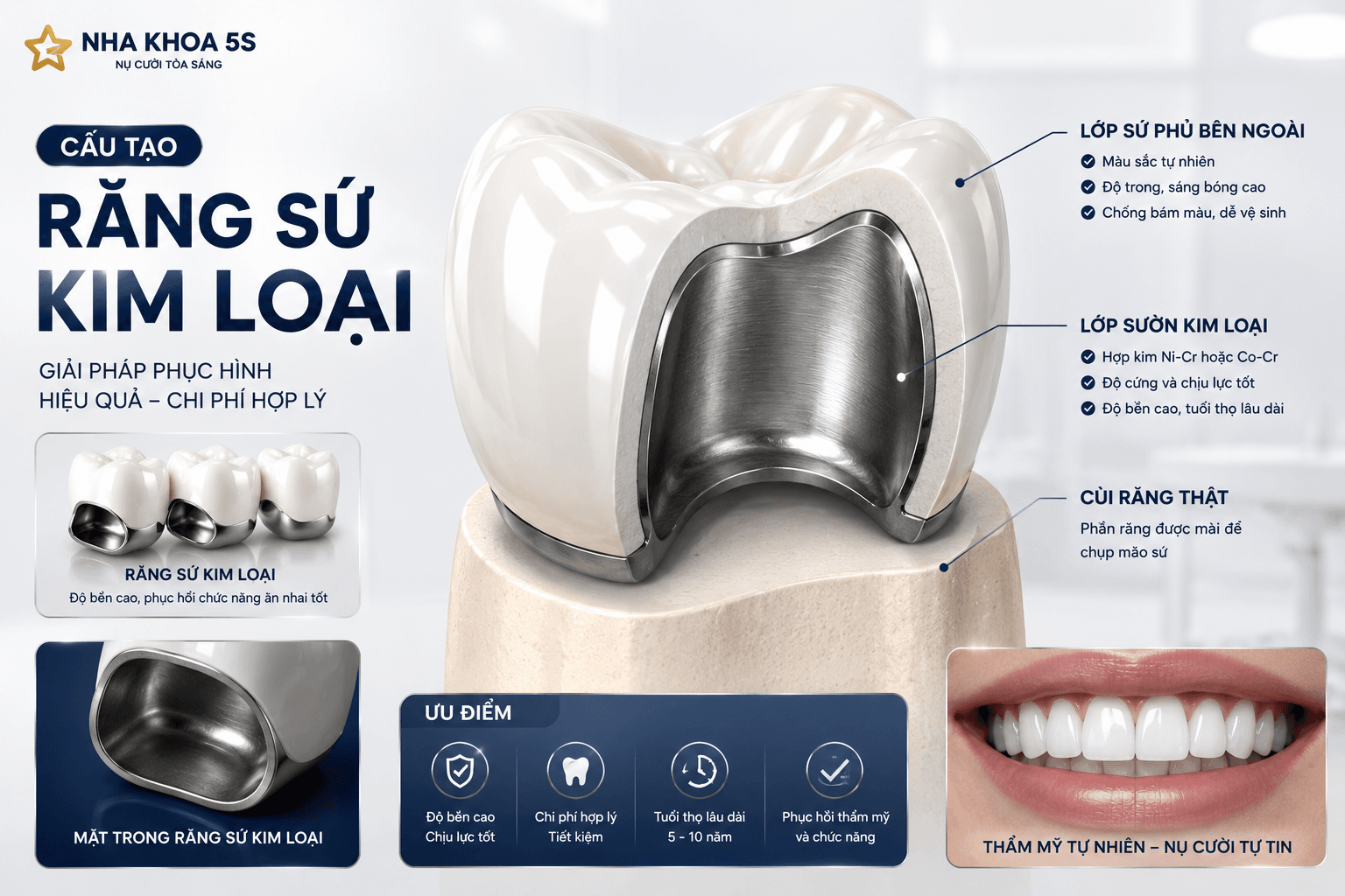 Các Loại Răng Sứ Phổ Biến Hiện Nay: Nên Chọn Loại Nào Tốt Nhất?