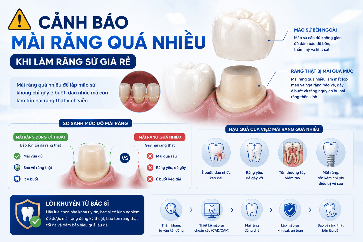 Răng Sứ Giá Rẻ Nguy Hiểm Thế Nào? 7 Rủi Ro Bạn Cần Biết Trước Khi Quyết Định
