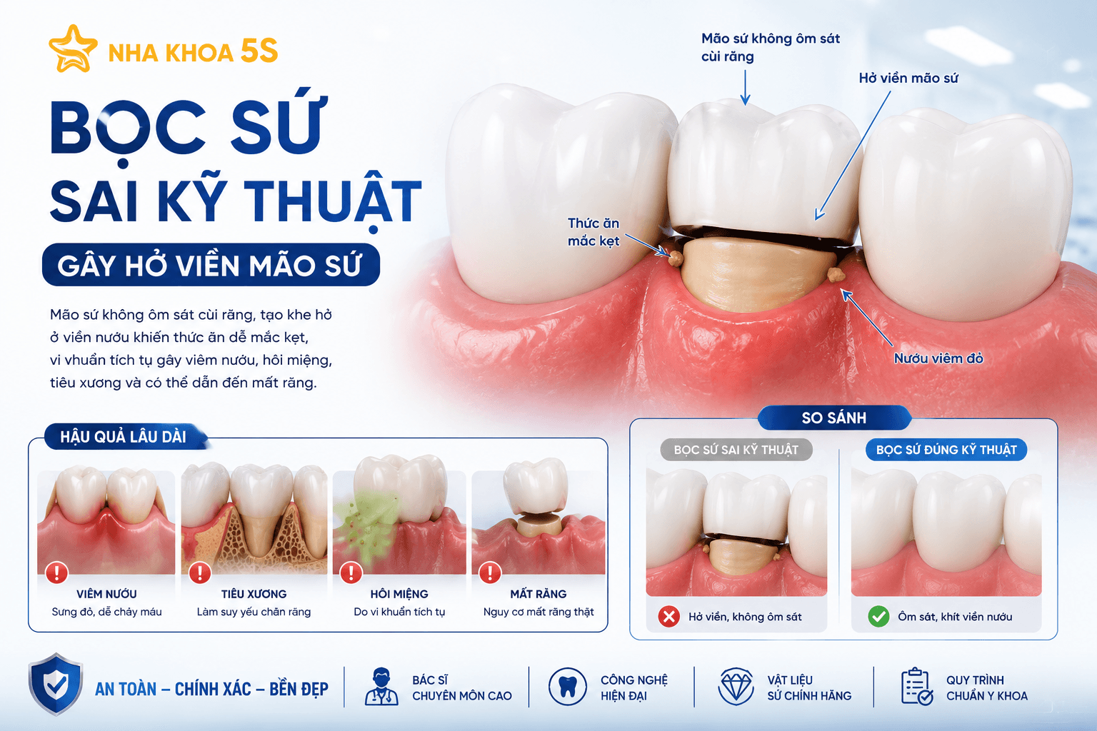 Bọc Sứ Sai Kỹ Thuật: 7Dấu Hiệu Cảnh Báo &Amp;Cách Khắc Phục 2026 Chatgpt Image 13 32 11 3 Thg 6 2026 4