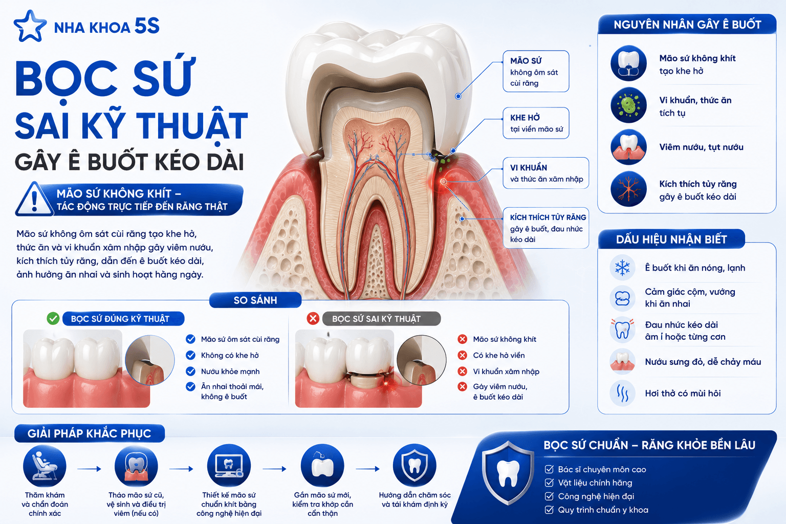 Bọc Sứ Sai Kỹ Thuật: 7Dấu Hiệu Cảnh Báo &Amp;Cách Khắc Phục 2026 Chatgpt Image 13 46 30 3 Thg 6 2026 4