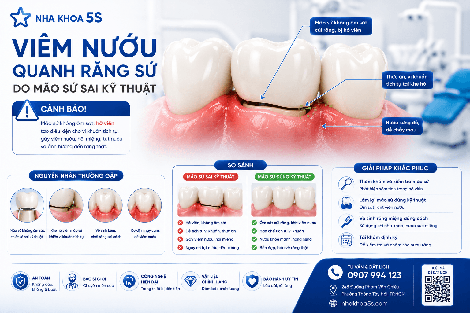 Bọc Sứ Sai Kỹ Thuật: 7Dấu Hiệu Cảnh Báo &Amp;Cách Khắc Phục 2026 Chatgpt Image 13 48 03 3 Thg 6 2026 4